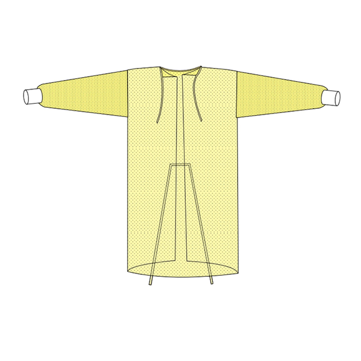 Gown, Procedure N/S Ylw Xlg 50" (10/Bg 10Bg/Cs), 100/Cs