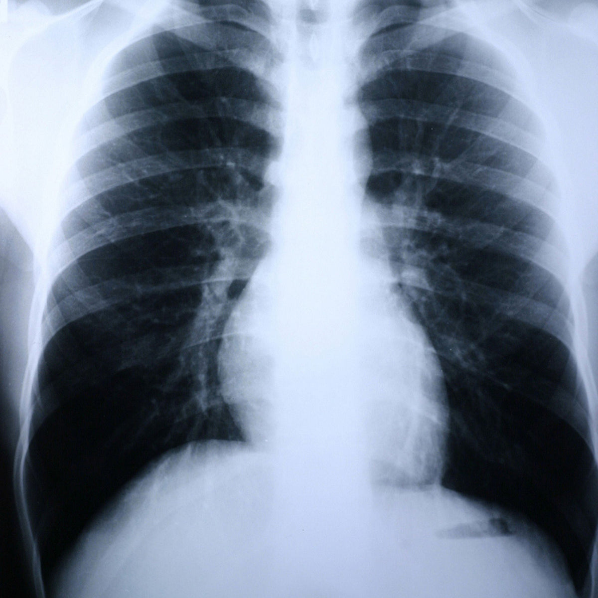 Clear Choice™ Performance X-Ray Film, 500/CS