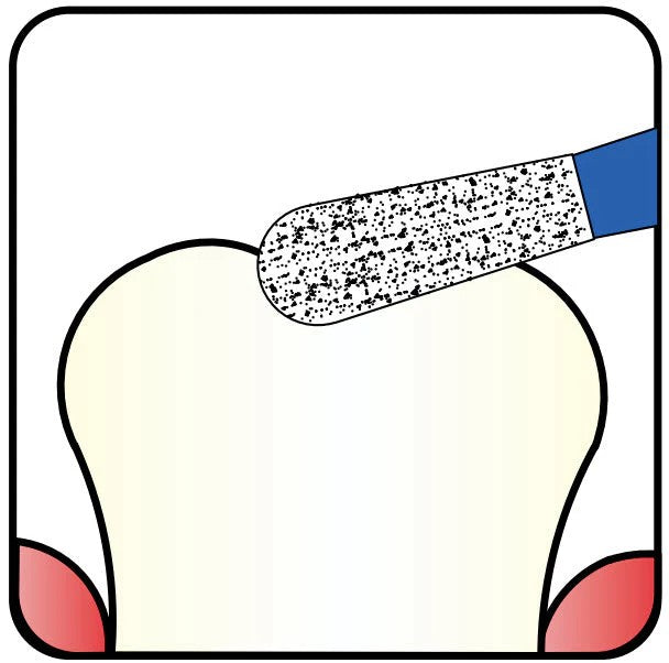 💎 Precision in Every Cut: Exploring the Diamond Bur 237 Pear Shape Series (1.0 mm to 3.2 mm)