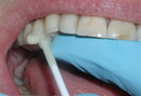 Pic N Stic 60/bx. - Pulpdent - BriteSources