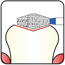 Double Conical, Symmetrical, Short 3.5 mm Dia. Medium Grit Diamond Bur 5 per pack. 037.35M2 - Osung USA