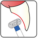 Wheel 4.2 mm Dia.  Medium Grit Diamond Bur 5 per pack. 068.42M1 - Osung USA