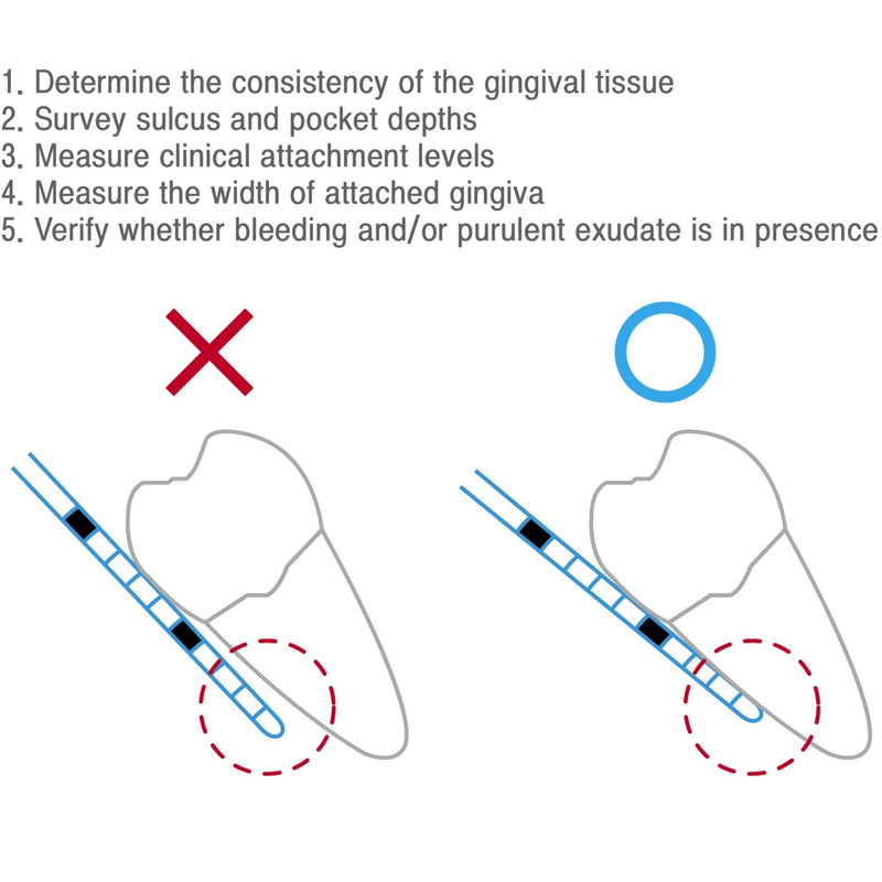 12N Dental Probe Metal handle Osung - BPCP12N - Osung USA