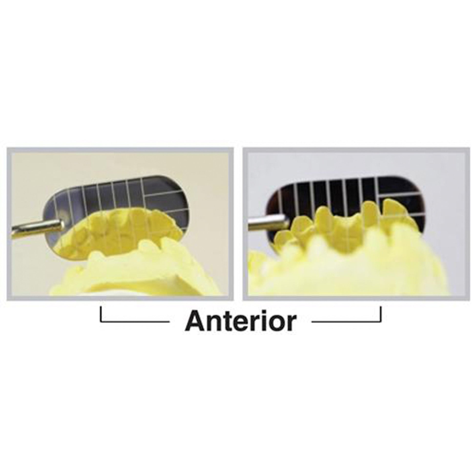 Dental Mirror, Parallel, Anterior, Autoclavable Silicone Handle, DMPRA - Osung USA