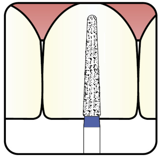 Conical, Dome End 1.6 mm Dia. Fine Grit Diamond Bur 5 per pack. 194.16F7 - Osung USA