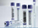 VACUETTE® VENOUS BLOOD COLLECTION TUBE, 2 ML, 13 X 75 MM, SOLD AS 1200/CASE GREINER 454222