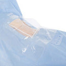 DRAPE, SURGICAL OBSTETRIC CLEAR VIEW SCREEN (24/CS), 24/CS