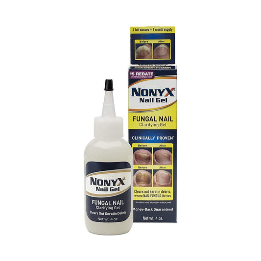 Nonyx Ethanoic Acid Antifungal, 4 Oz. Bottle, 1/Ea