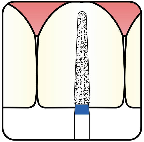 Torpedo, Conical 1.8 mm Dia. Extra Coarse Grit Diamond Bur 5 per pack. 294.18EC3 - Osung USA