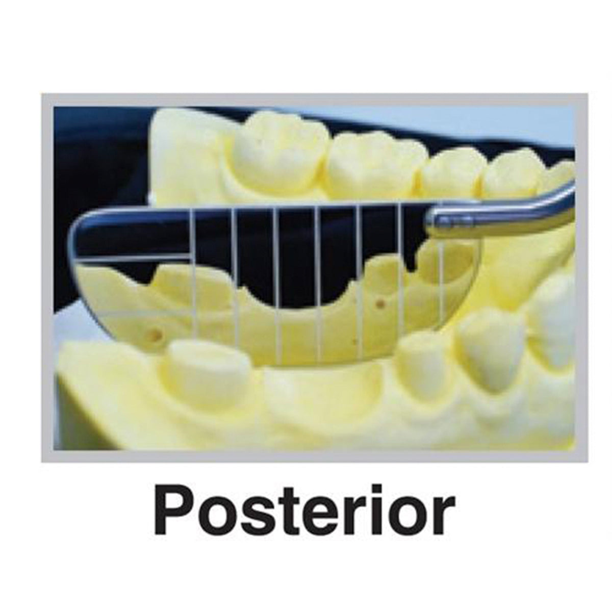 Dental Mirror, Parallel, Posterior, Autoclavable Silicone Handle, DMPRP - Osung USA