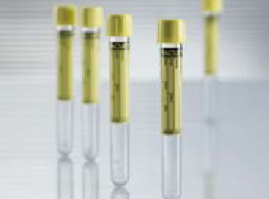 Vacuette® Urinalysis Tube, 9 mL, 16 x 100 mm, 50/BX
