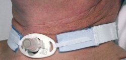 AIRLIFE® TRACHEOSTOMY TUBE HOLDER, SOLD AS 100/CASE SUN RES242A