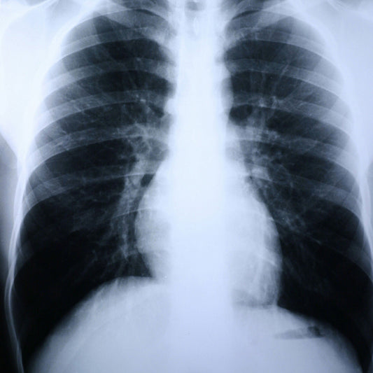 Clear Choice™ Performance X-Ray Film, 100/BX