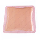 ALLEVYN GENTLE BORDER SILICONE FOAM DRESSING, 7 X 7 INCH, SOLD AS 10/BOX SMITH 66800280