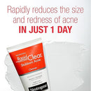 J&J Neutrogena Skin Care Cleanser 6.7Oz 3/Bx 4Bx/Cs -05635 - BriteSources