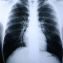 Clear Choice™ Performance X-Ray Film, 100/BX