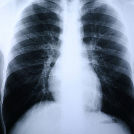 Clear Choice™ Performance X-Ray Film, 500/CS