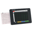 CARDIOVIT FT-1 WITH CONNECTIVITY KIT, INCLUDES: 0A.106000 + CONNECTIVITY CAPABILITY THROUGH DICOM / HL7 / PDQ, SOLD AS EACH SCHILLER 10001080