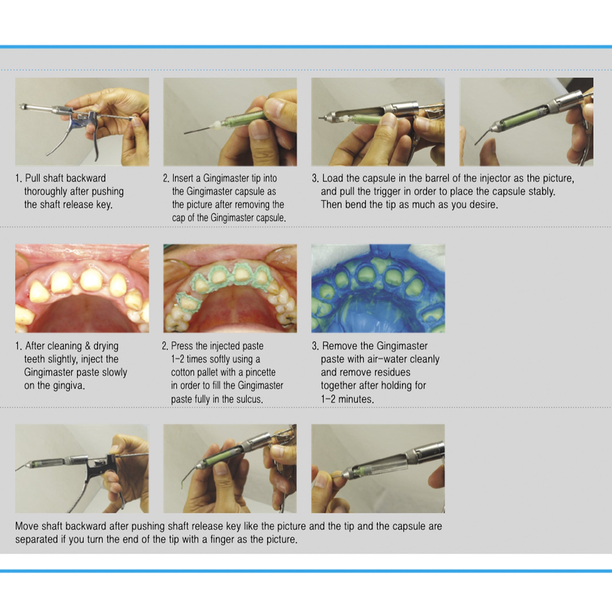 Osung Gingimaster Injector Applicator -GMIJ48 - Osung USA