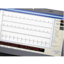 VECTRAPLEX ECG SOFTWARE ONLY, 5 ELECTRODE 15-LEAD REPORT WITH CEB AND STANDARD 10 ELECTRODE 12-LEAD ECG REPORT, SOLD AS EACH VECTRACOR, 10000858