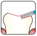 Conical, Round Edge 2.1 mm Dia. Extra Coarse Grit Diamond Bur 5 per pack. 584.21EC2 - Osung USA