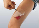 CUTICERIN IMPREGNATED DRESSING, 3 X 8 INCH, SOLD AS 120/CASE SMITH 66045563