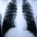 Clear Choice™ Performance X-Ray Film, 500/CS