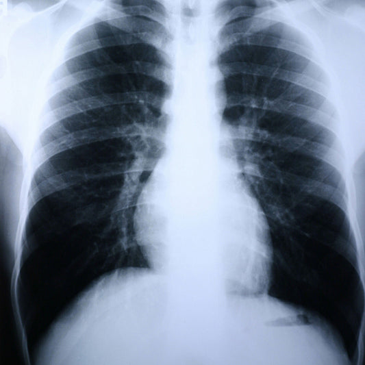Clear Choice™ Performance X-Ray Film, 500/Cs