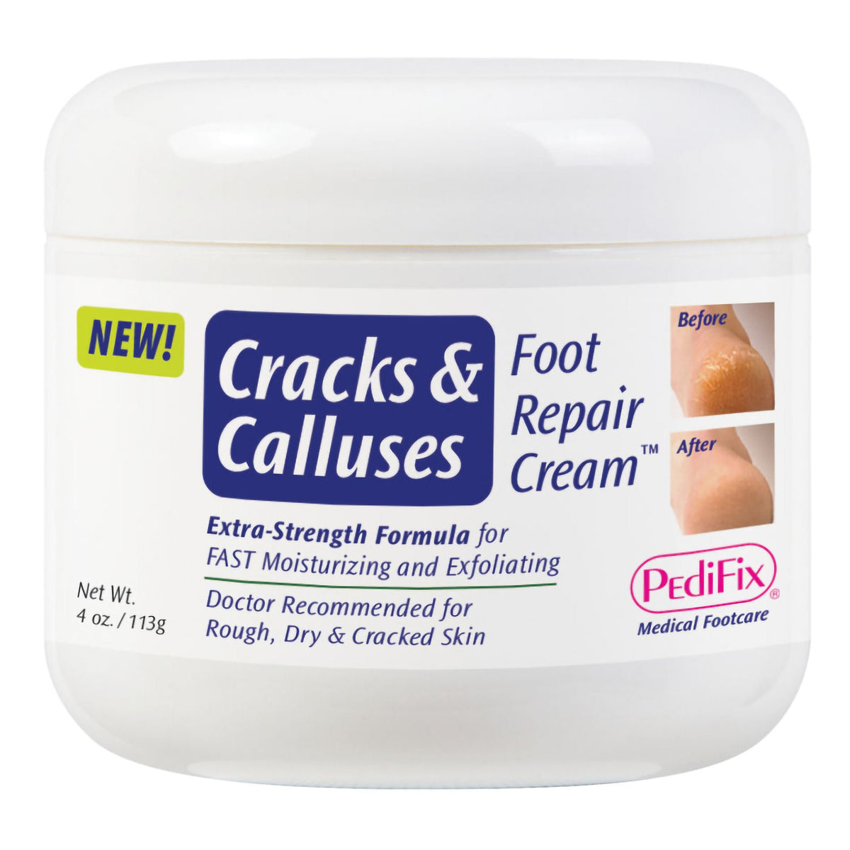 Pedifix® Cracks And Calluses Foot Repair Cream™, 4-Ounce Jar, 1/Ea
