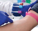 WRISTBAND/HOLDER SETF/TUBE JOCKEY, 1/EA