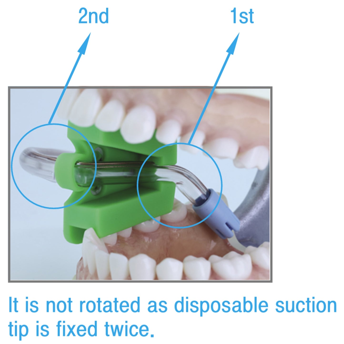 Osung Medium Mouth Prop Autoclavable -MPM - Osung USA