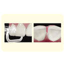 Osung Interproximal Enamel reduction (IPR) Diamond Strip Orthodontic Strips Straight-Edge - Osung USA