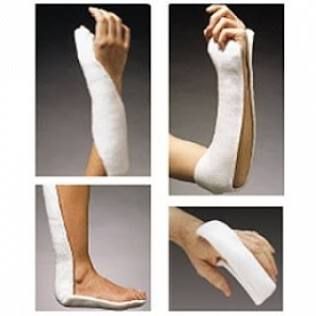 Cast Splint 3X12 Orth-Gls10/Cs, 10/Cs