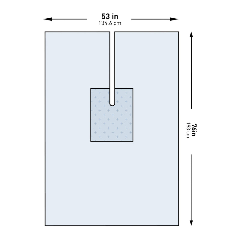 McKesson Sterile U-Drape with Split, 53 x 76 Inch