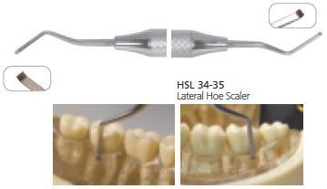Dental Lateral Hoe Scaler, HSL34-35 - BriteSources