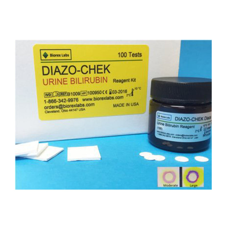Diazo-Chek, F/Urine Bilirubin Biorex Labs (100/Kt), Sold As 1/Kit Fisher B1009