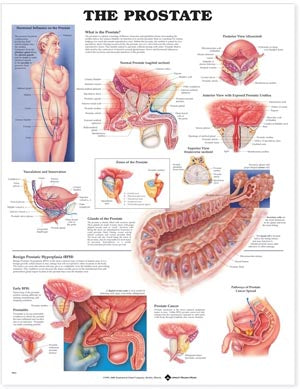 Anatomical Charts & Posters. Prostate Anatomical Chart, 20" X 26", Heavy Weight Paper Laminated With Grommets At Top Corners (092602) (Drop Ship Only)