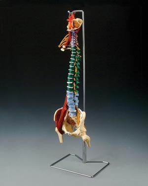 Anatomical Musculature Model. Muscled Spine Model With Disorders, Stand Included (092603) (Drop Ship Only). Model Spine Muscle Disorderw/Stand (Drop),