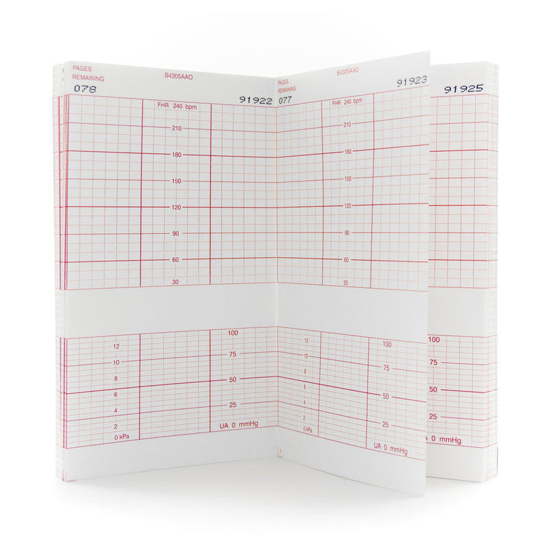 Mckesson Fetal Monitoring Paper, Sold As 160/Pack Mckesson 26-B4305A